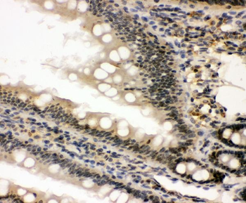 Anti-nmt55/p54nrb/NONO Antibody