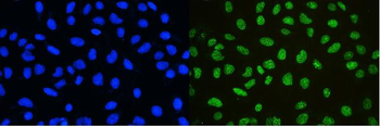 Anti-nmt55/p54nrb/NONO Antibody