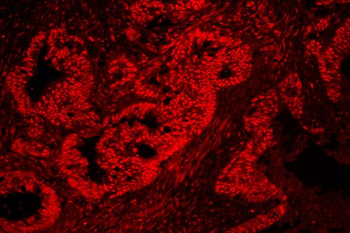 Anti-nmt55/p54nrb/NONO Antibody