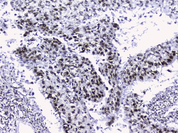 Anti-nmt55/p54nrb/NONO Antibody