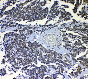 Anti-nmt55/p54nrb/NONO Antibody