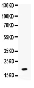 Anti-NAP2/PPBP Antibody