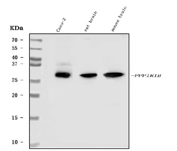 DARPP32/PPP1R1B Antibody