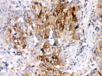 Anti-DARPP32/PPP1R1B Antibody