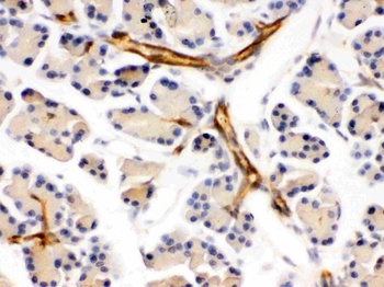 DARPP32/PPP1R1B Antibody