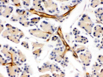 Anti-DARPP32/PPP1R1B Antibody
