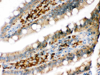 Anti-DARPP32/PPP1R1B Antibody