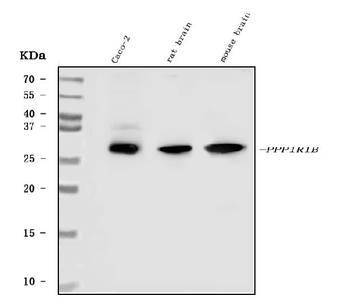 Anti-DARPP32/PPP1R1B Antibody