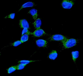 Anti-RAB7/RAB7A Antibody