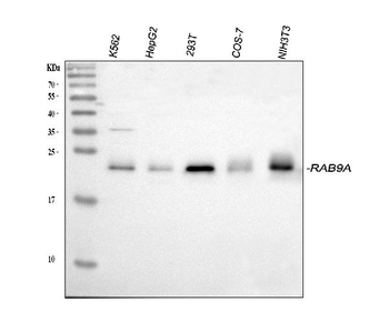 Anti-Rab9/RAB9A Antibody
