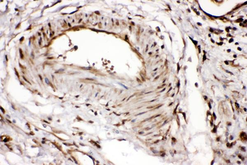 Anti-Ribonuclease Inhibitor/RNH1 Antibody