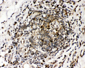 Anti-Ribonuclease Inhibitor/RNH1 Antibody