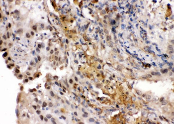Anti-Ribonuclease Inhibitor/RNH1 Antibody