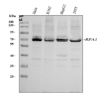 RPA70/RPA1 Antibody