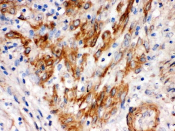 SFRP4 Antibody