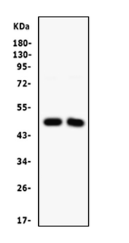 Anti-SFRP4 Antibody