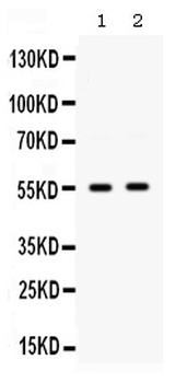 GLUT9/SLC2A9 Antibody