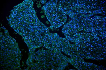 Anti-GLUT9/SLC2A9 Antibody