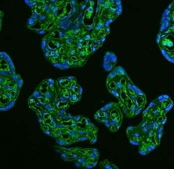 Anti-GLUT9/SLC2A9 Antibody