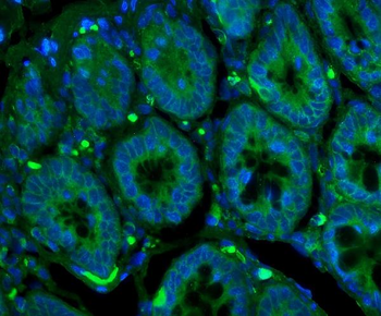 Anti-GLUT9/SLC2A9 Antibody