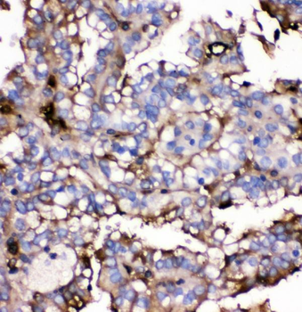 Anti-GLUT9/SLC2A9 Antibody