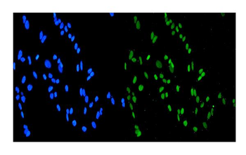 Anti-SMURF1 Antibody