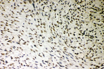 Anti-SMURF1 Antibody