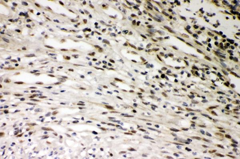 Anti-SMURF1 Antibody