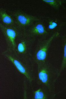 Anti-SPTLC1 Antibody