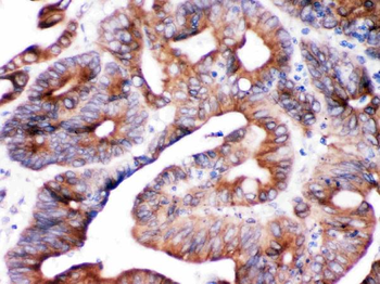 Anti-SPTLC1 Antibody