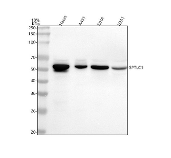 Anti-SPTLC1 Antibody