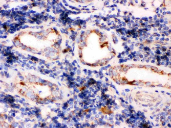 TPP1 Antibody