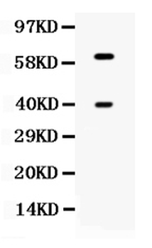 TPP1 Antibody