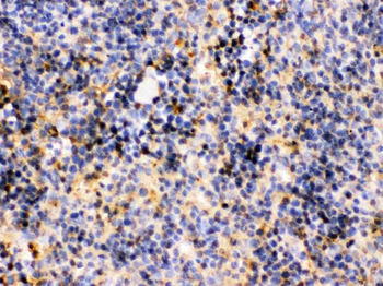 Anti-TRIB2 Antibody