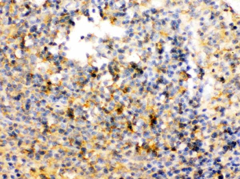 Anti-TRIB2 Antibody