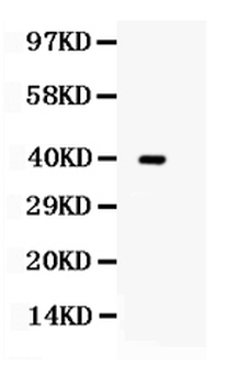 Anti-TRIB2 Antibody