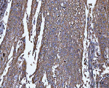 Anti-TRPM4 Antibody
