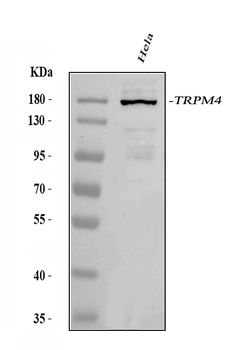 Anti-TRPM4 Antibody