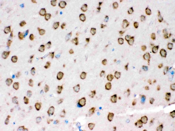 Anti-TRPM5 Antibody