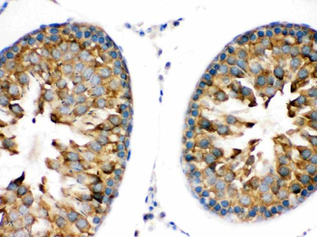 Anti-TRPM5 Antibody