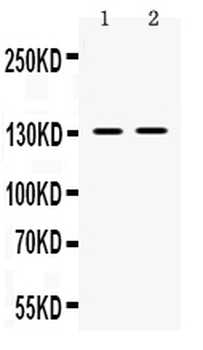 Anti-TRPM5 Antibody