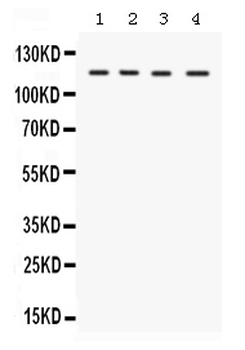 E1 Ubiquitin Activating Enzyme/UBA1 Rabbit Polyclonal Antibody