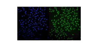 Anti-UHRF1 Antibody
