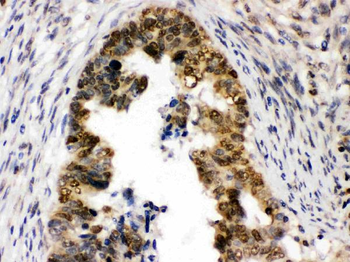 Anti-UHRF1 Antibody