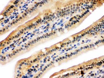 Anti-NIRF/UHRF2 Antibody