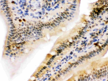 Anti-NIRF/UHRF2 Antibody