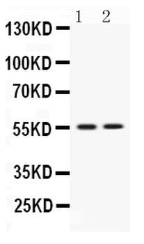 VRK1 Rabbit Polyclonal Antibody