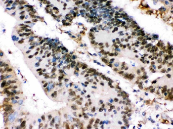 XRCC4 Rabbit Polyclonal Antibody
