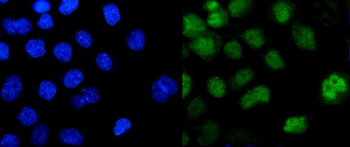 Anti-ZBTB7A Antibody