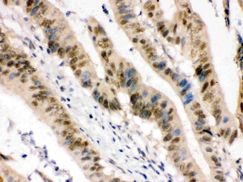 Anti-ZBTB7A Antibody